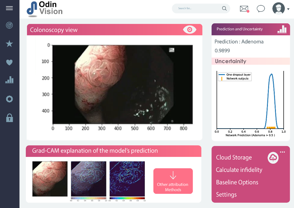 Screenshot of the Odin Vision user interface